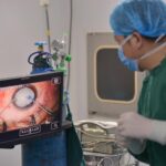 Praticien ophtalmologue fait une intervention sur l,oeil d'un patient